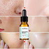 Pore Shrinking Face Serum (30 ml)